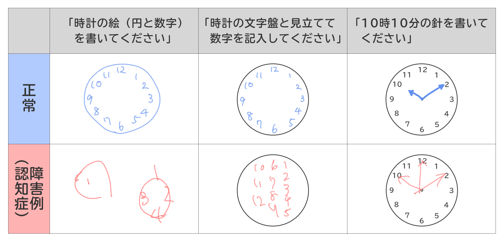 医師監修 長谷川式認知症スケール Hds R とは 他の認知症検査と比較して解説 サービス付き高齢者向け住宅の学研ココファン