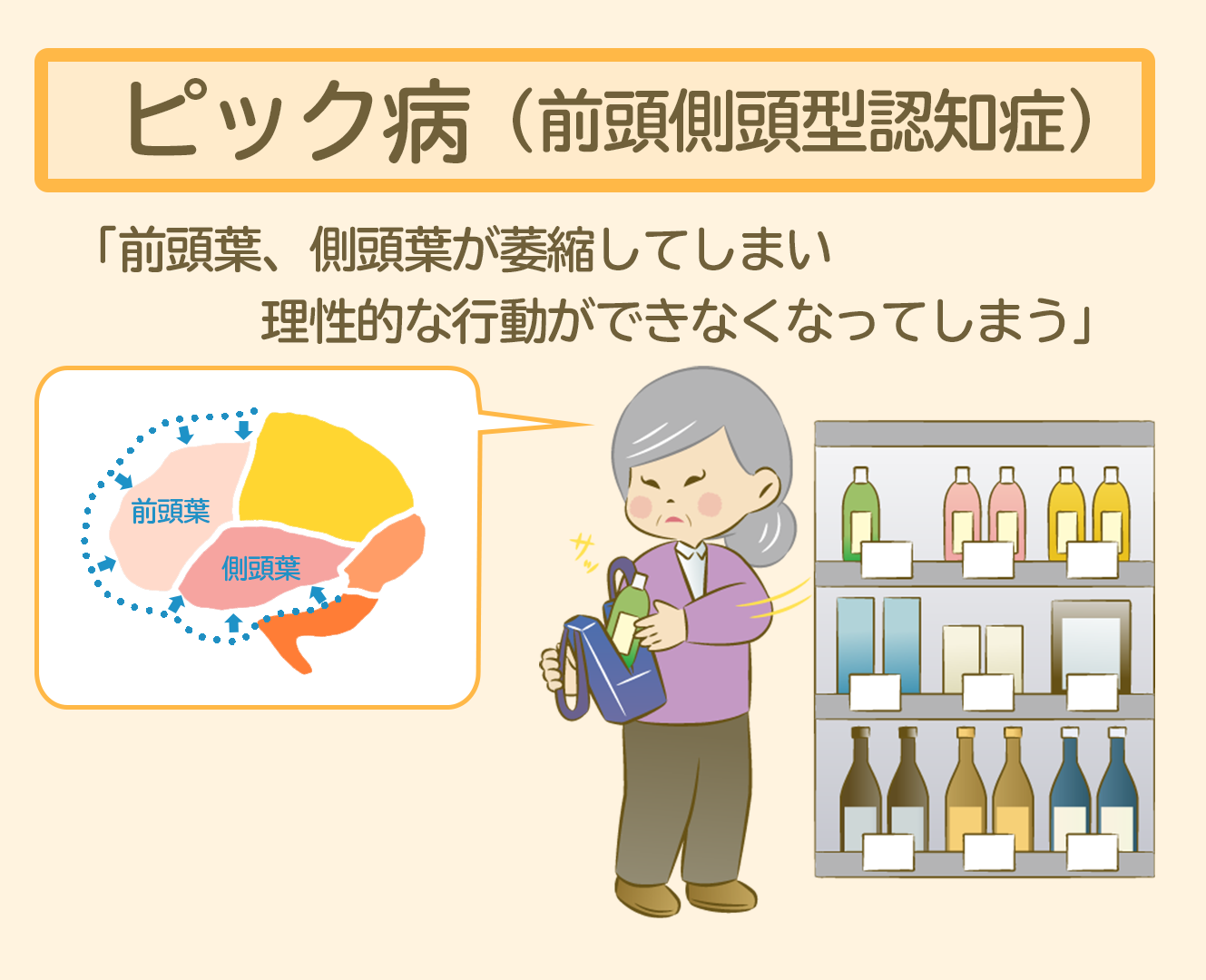 医師監修 前頭側頭型認知症 ピック病 とは 症状や原因 治療法まで全て紹介 サービス付き高齢者向け住宅の学研ココファン