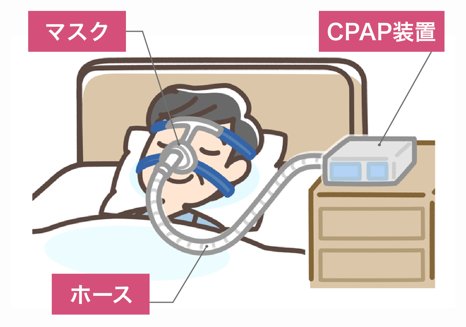 医師監修 睡眠時無呼吸症候群の対策 原因や症状 治療方法まで詳しく解説 サービス付き高齢者向け住宅の学研ココファン