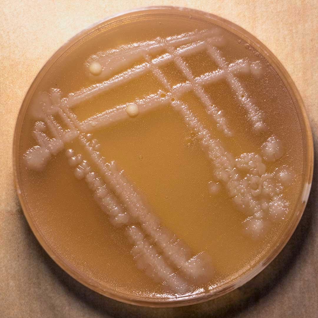 A photo of an agar plate with white blobs visible on a tan gel.