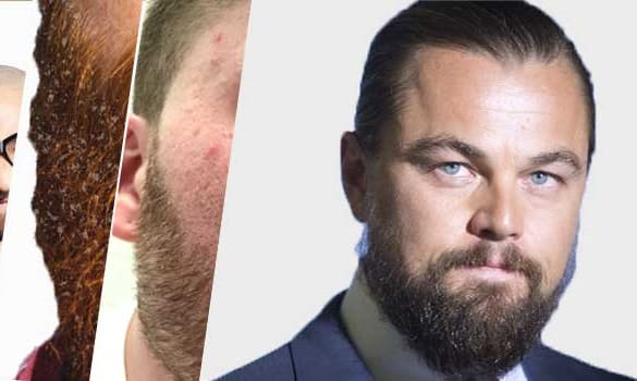 7 Common Teenage Beard Problems And Solutions Teenager Facial Hair Men S Care This will fill in thin parts and even out your beard. 7 common teenage beard problems and