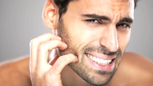 beard itching