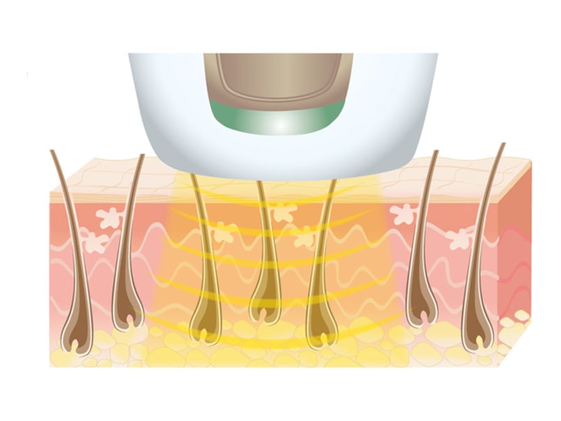 La mélanine des cheveux absorbe la lumière.