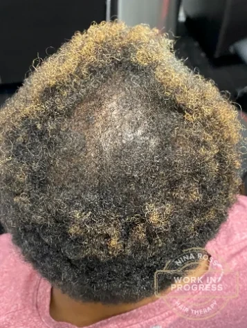 CCCA after trichology care at Nina Ross Atlanta