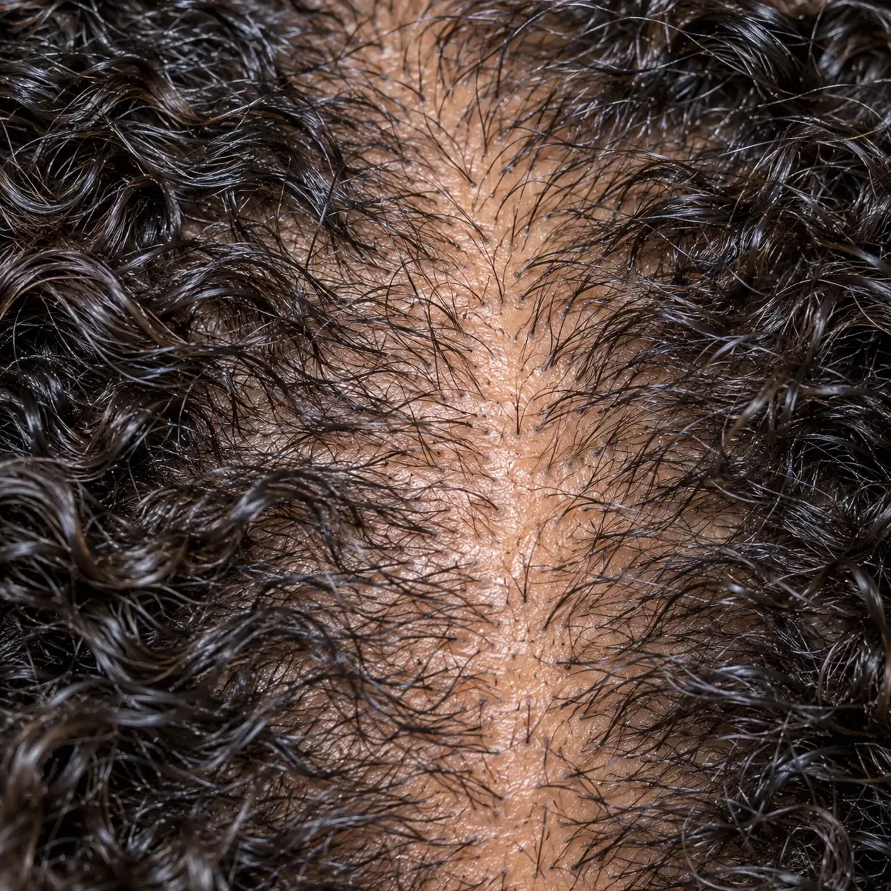 200x view of the part line filling back in, with new hairs of uneven lengths growing from the same openings