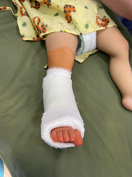 Baby's foot