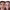 Microneedling or Collagen Induction Therapy cover