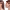Kybella cover