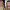 Kaley Cuoco's Rhinoplasty cover