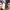 Zac Efron - Posible rinoplastia y retoques faciales cover