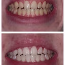 Best Cosmetic Dental Treatments for Confidence cover