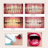 Los diseños de sonrisa más espectaculares para novios y novias cover