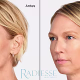 Los Bioestimuladores de Colágeno Más Recomendados por Expertos cover