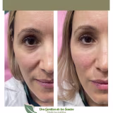 Best clinics for facial harmonization with natural results cover