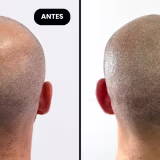 Men's touch-ups with the most natural results ('No one will notice' effect). cover