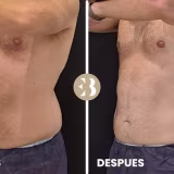 Innovative non-surgical fat removal solutions cover