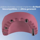Best value-for-money dental clinics in Segovia cover