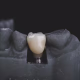 Dental laboratories with Digital Smile Design (DDS) in Andalusia cover