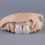 Laboratorios de prótesis dental con tecnología CAD/CAM en Aragón cover