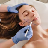 Best neuromodulator clinics in Spain cover