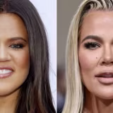 Celebrities who openly talk about their surgeries cover