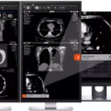 Best AI-powered predictive medical diagnosis platforms cover