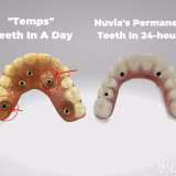 Clinics specialized in titanium dental implants cover