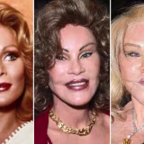 Cirugías estéticas de famosos más caras cover