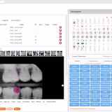 Mejores soluciones de diagnóstico digital para clínicas dentales cover