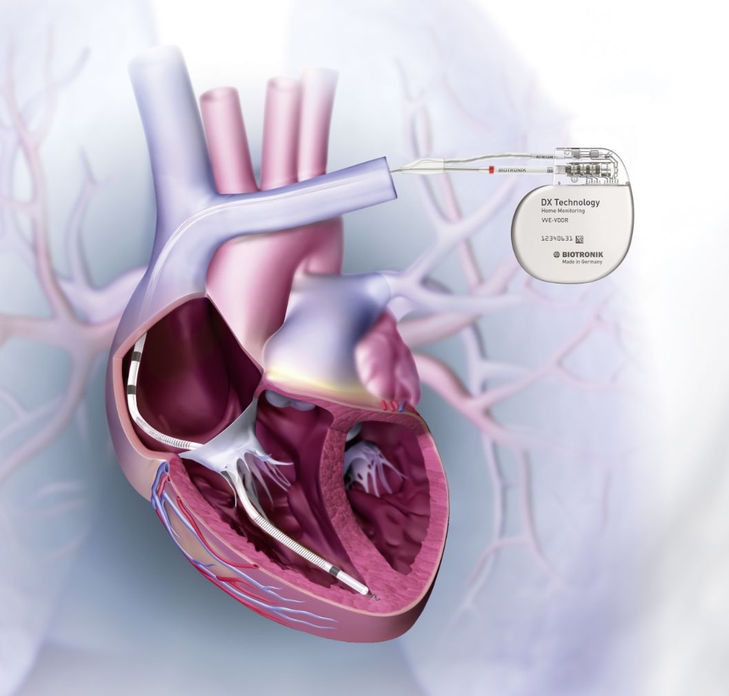 Biotronik single chamber icd