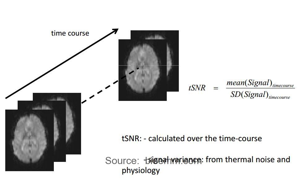 مفهوم tSNR در تصاویر fMRI