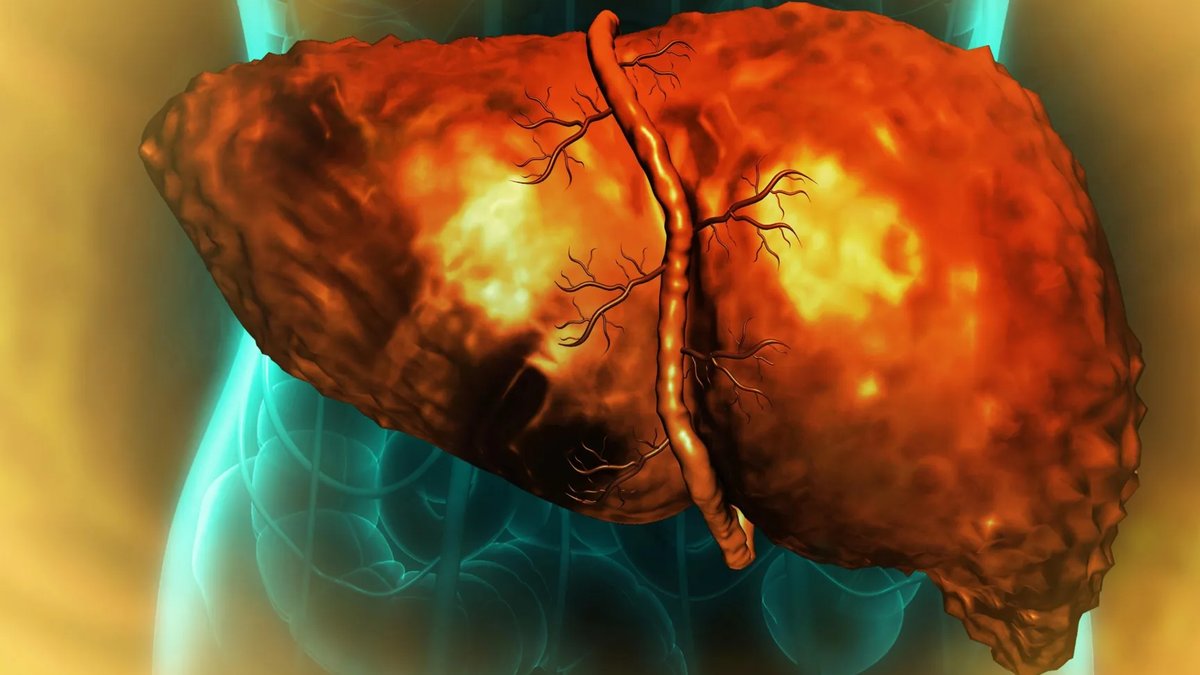 Researchers Identify Why Liver Fails to Recover - liver regeneration