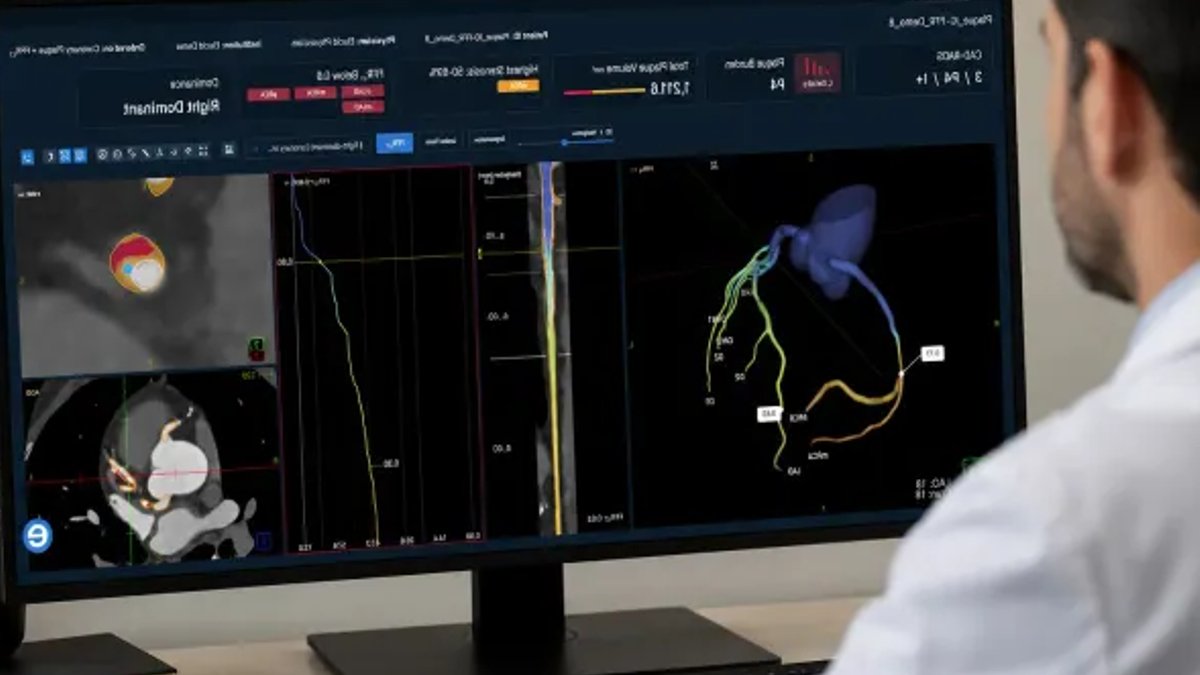 Elucid Secures $55M to Advance Cardiac Imaging Elucid Secures $55M to Advance Cardiac Imaging - cardiac imaging