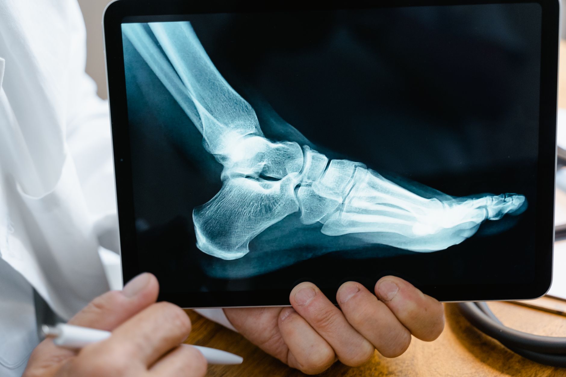 Ingrown Toenails – Surgery Solves Foot Problem