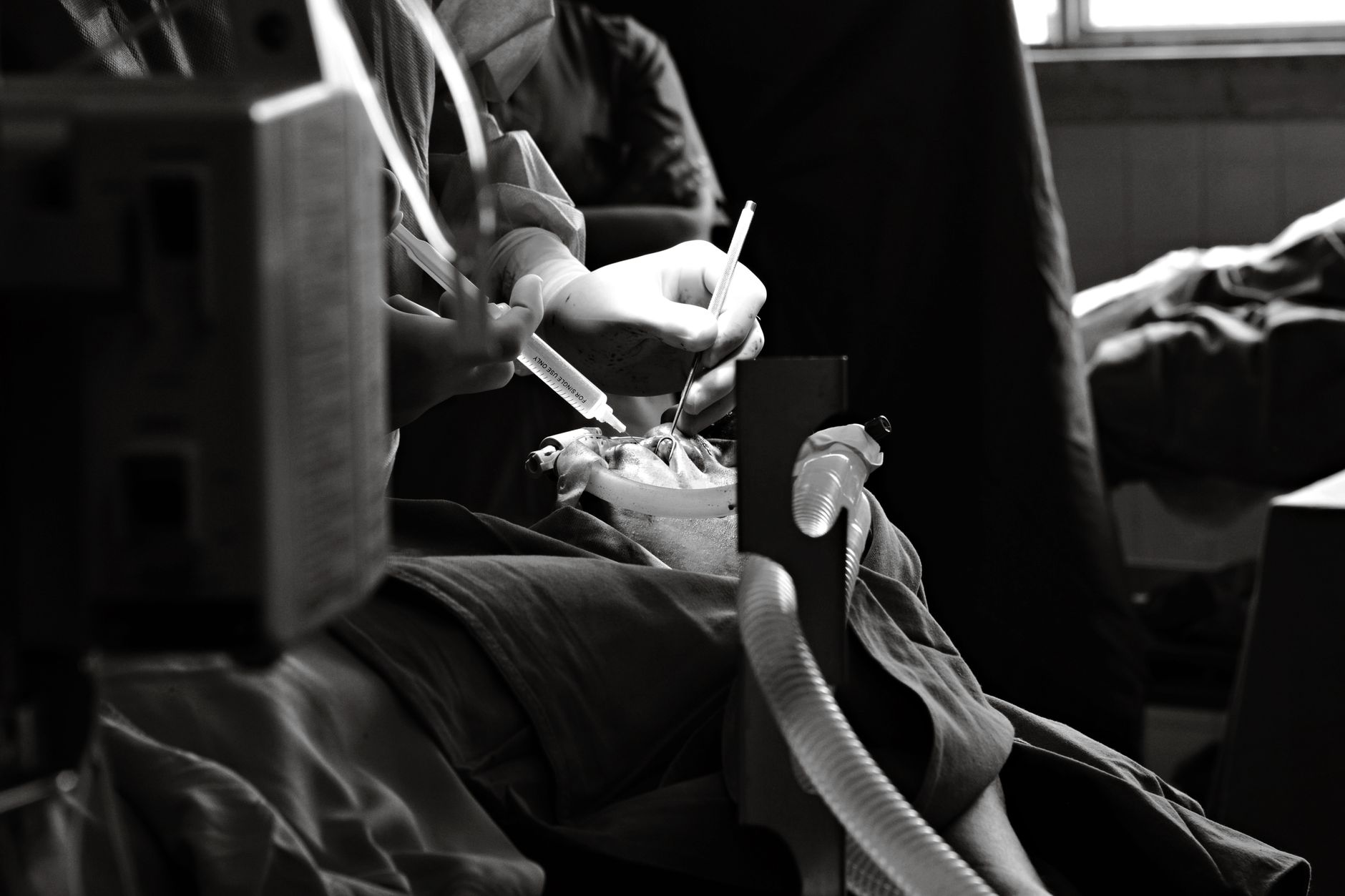 Understanding the Work of a Vascular Surgeon