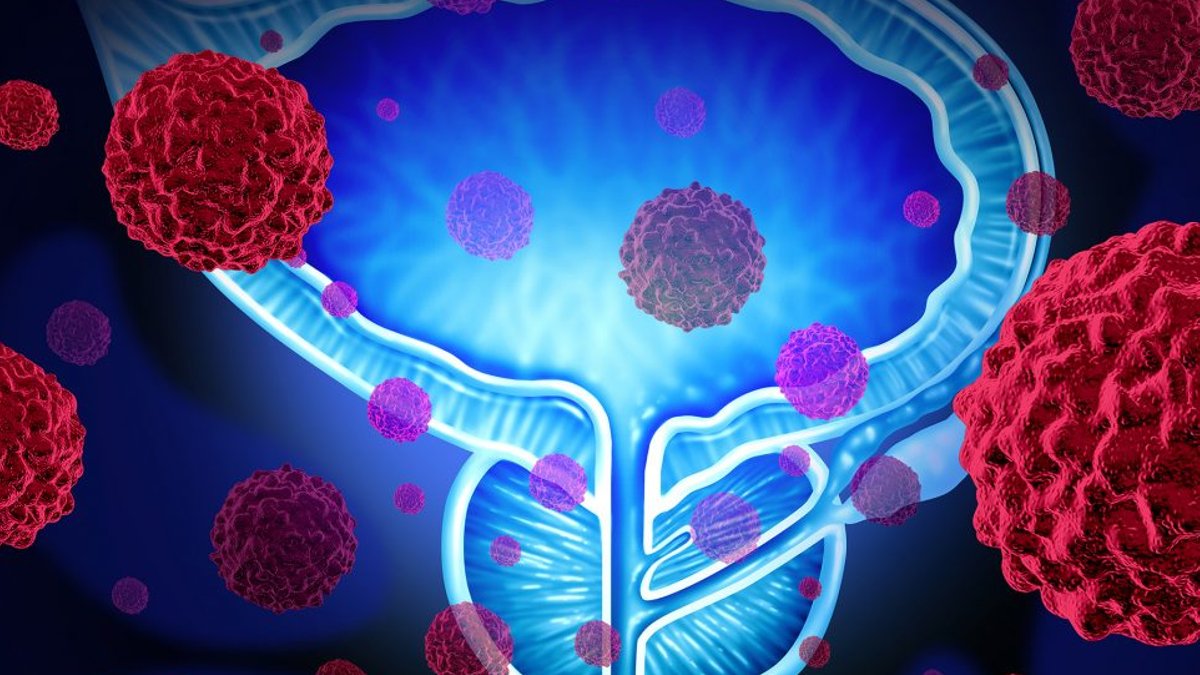 Genes reveal prostate cancer risks and treatment clues Genes reveal prostate cancer risks and treatment clues - prostate cancer genes