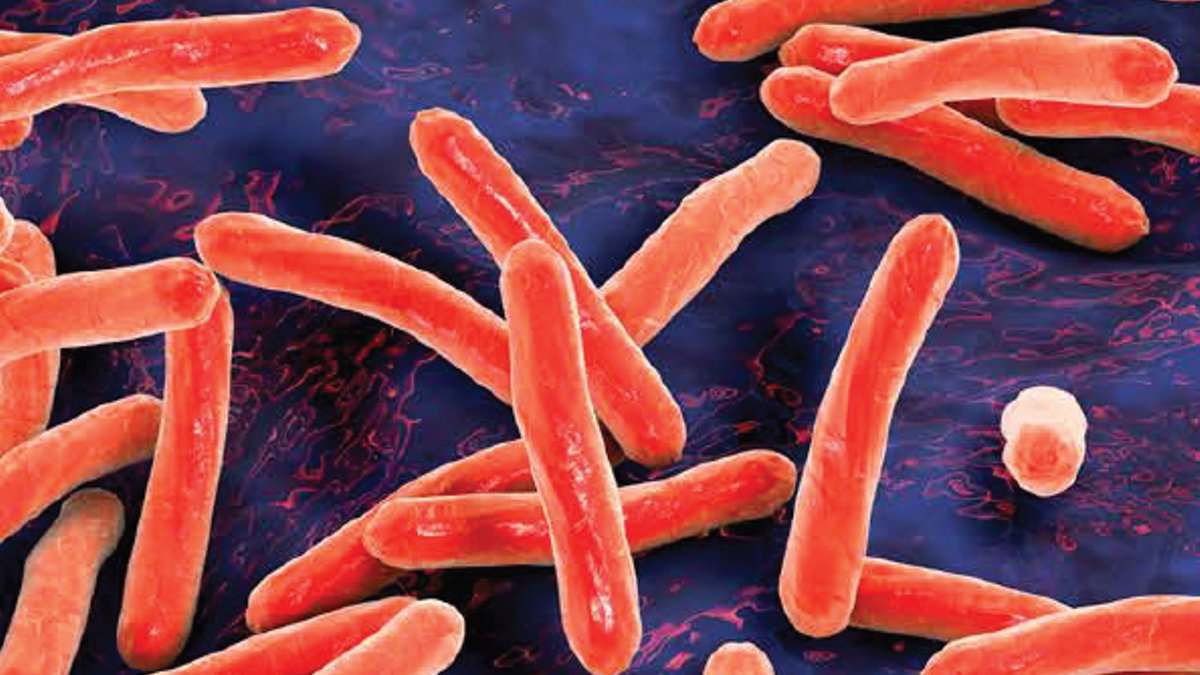 New TB treatment could cut latent infection fast New TB treatment could cut latent infection fast - fast tb treatment