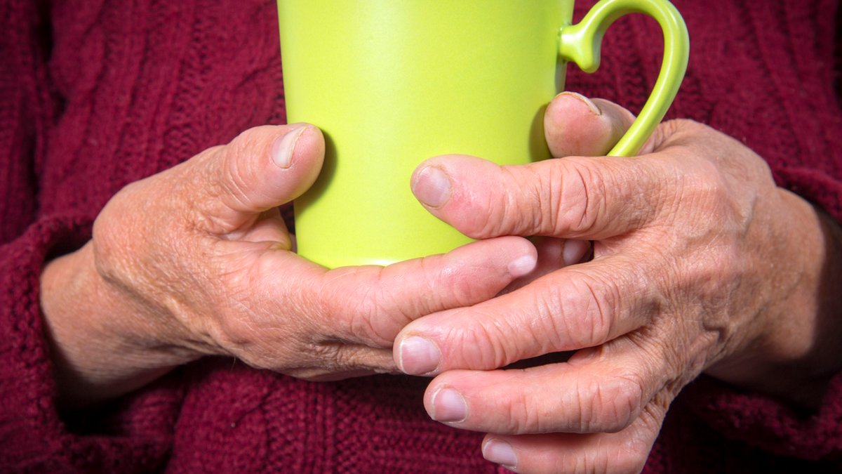 Study Links High Air Pollution to Rheumatoid Arthritis Flares - air pollution rheumatoid arthritis