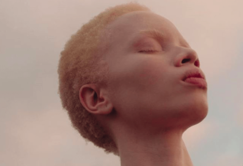 South African Model Thando Hopa Makes History As First Albino Person To Cover Vogue Magazine Blavity News