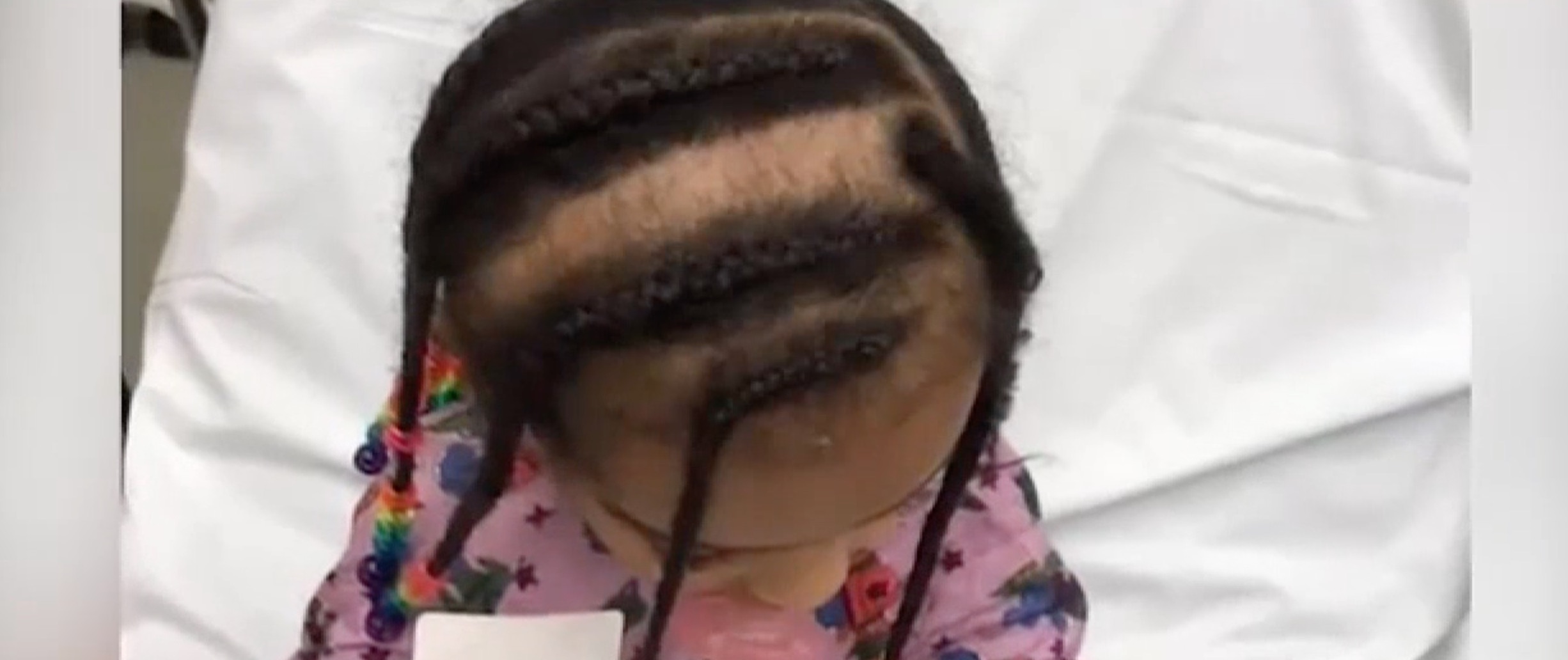 Illinois Daycare Accused Of Ripping Toddler's Braid From Her Scalp During Nap Time