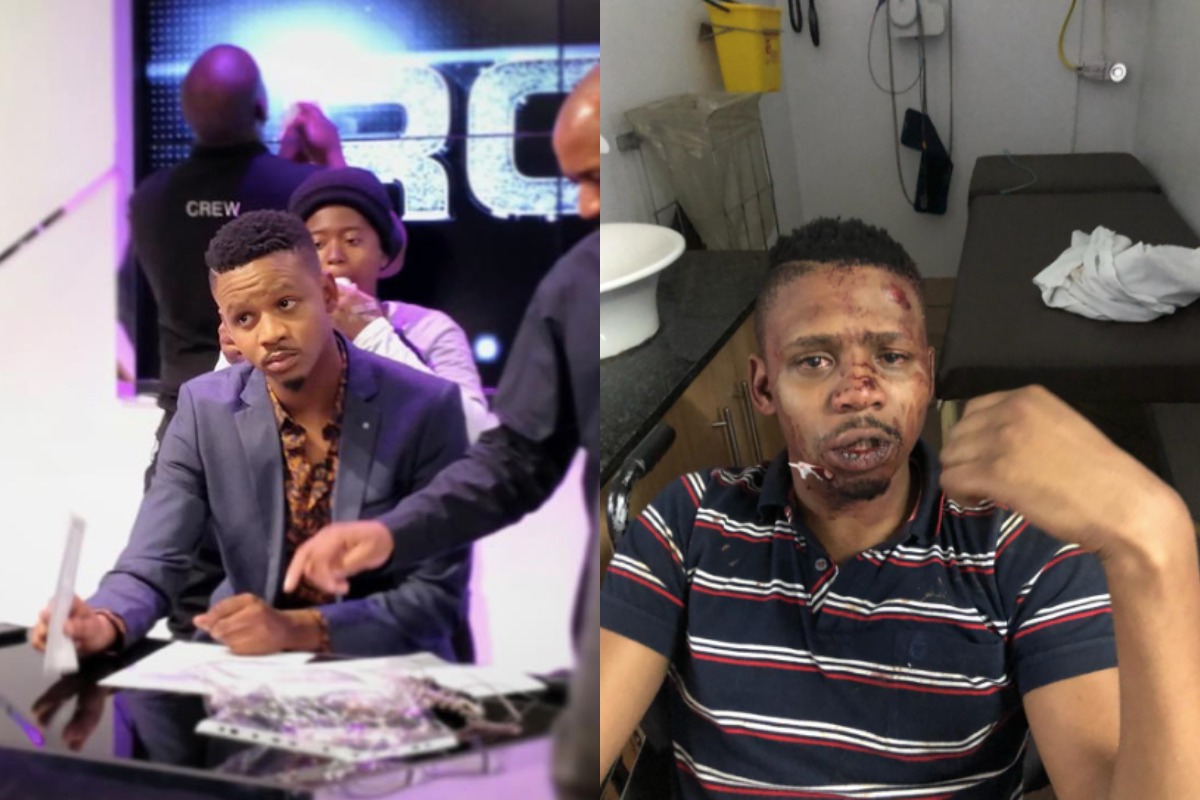 South African Newscaster Says He Was Called A 'Monkey' And Beaten By White Men He Was Trying To Help