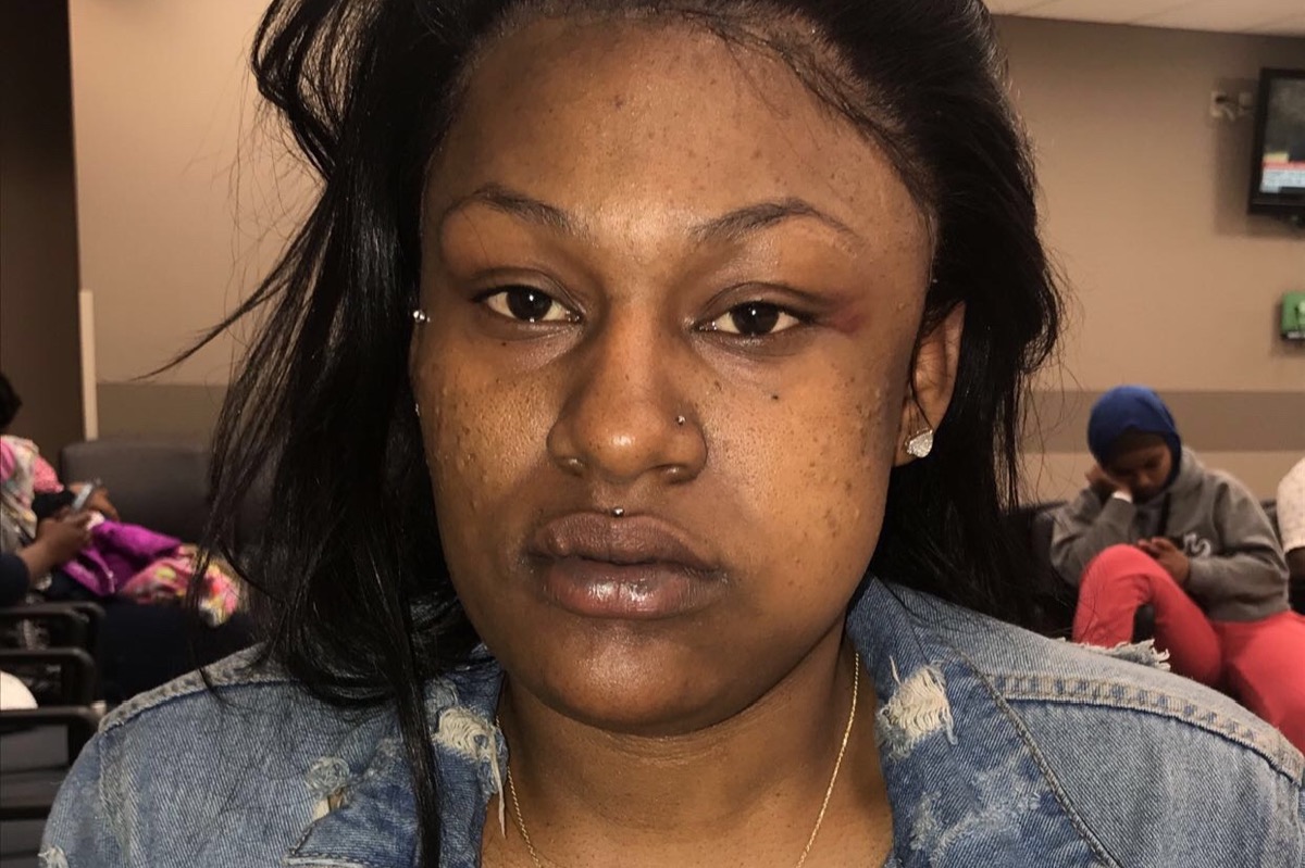 GoFundMe Donations Pour In For L’Daijohnique Lee After She Was Charged With A Felony Following Brutal Attack By White Man