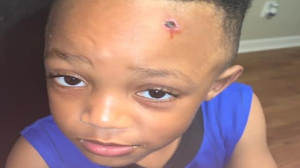 Mom Enraged After Fake Bullet Wound Painted On Son's Head During Drama Class: 'This Actually Happens To Our Young Black Men'