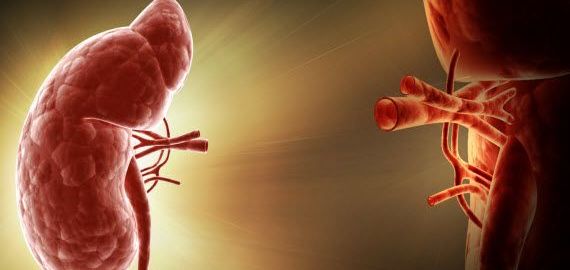 Kidney Transplant