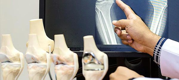 Types of knee prosthesis