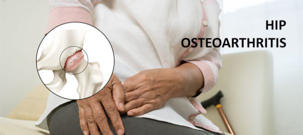 Hip Osteoarthritis