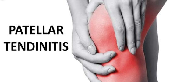 Patellar Tendinitis