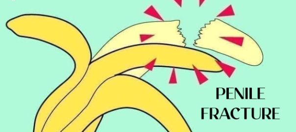 Penile Fracture
