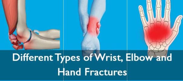 Elbow Wrist Fracture