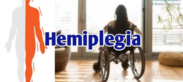 Hemiplegia